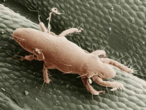 Immagine di acari ingranditi al microscopio che illustra uninfestazione, collegata allarticolo sulle strategie preventive contro le infestazioni da acari