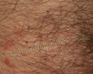 Bottiglia di veleno per blatte su sfondo bianco utilizzato come soluzione per infestazioni di insetti
